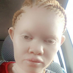 alb